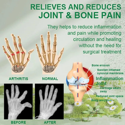 Bee Venom Bone and Joint Therapy Cream - (Buy 1 get 2 Free🔥)
